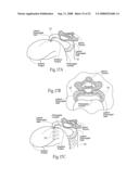 Devices, systems, and methods to fixate tissue within the regions of body, such as the pharyngeal conduit diagram and image