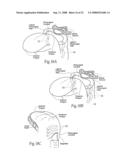 Devices, systems, and methods to fixate tissue within the regions of body, such as the pharyngeal conduit diagram and image