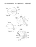 Devices, systems, and methods to fixate tissue within the regions of body, such as the pharyngeal conduit diagram and image