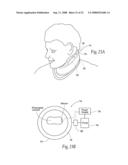 Devices, systems, and methods to fixate tissue within the regions of body, such as the pharyngeal conduit diagram and image