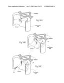 Devices, systems, and methods to fixate tissue within the regions of body, such as the pharyngeal conduit diagram and image