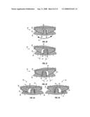 SURGICAL IMPLANT SECURED BY PEGS AND ASSOCIATED METHODS diagram and image