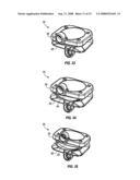 SURGICAL IMPLANT SECURED BY PEGS AND ASSOCIATED METHODS diagram and image