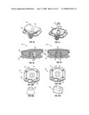 SURGICAL IMPLANT SECURED BY PEGS AND ASSOCIATED METHODS diagram and image