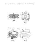 SURGICAL IMPLANT SECURED BY PEGS AND ASSOCIATED METHODS diagram and image