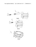 SURGICAL IMPLANT SECURED BY PEGS AND ASSOCIATED METHODS diagram and image