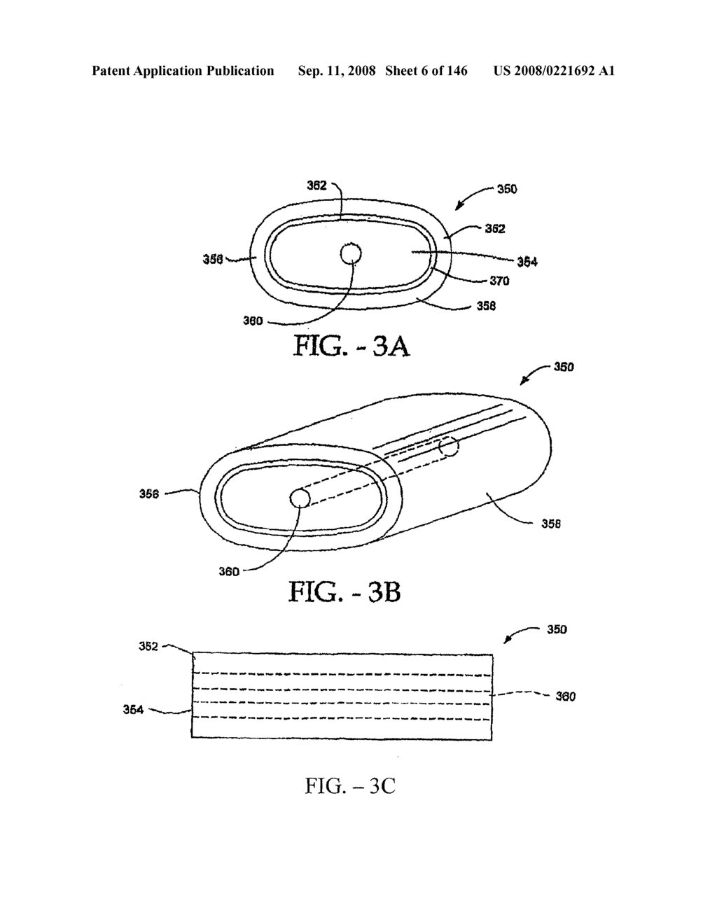 INTERSPINOUS PROCESS IMPLANTS AND METHODS OF USE - diagram, schematic, and image 08