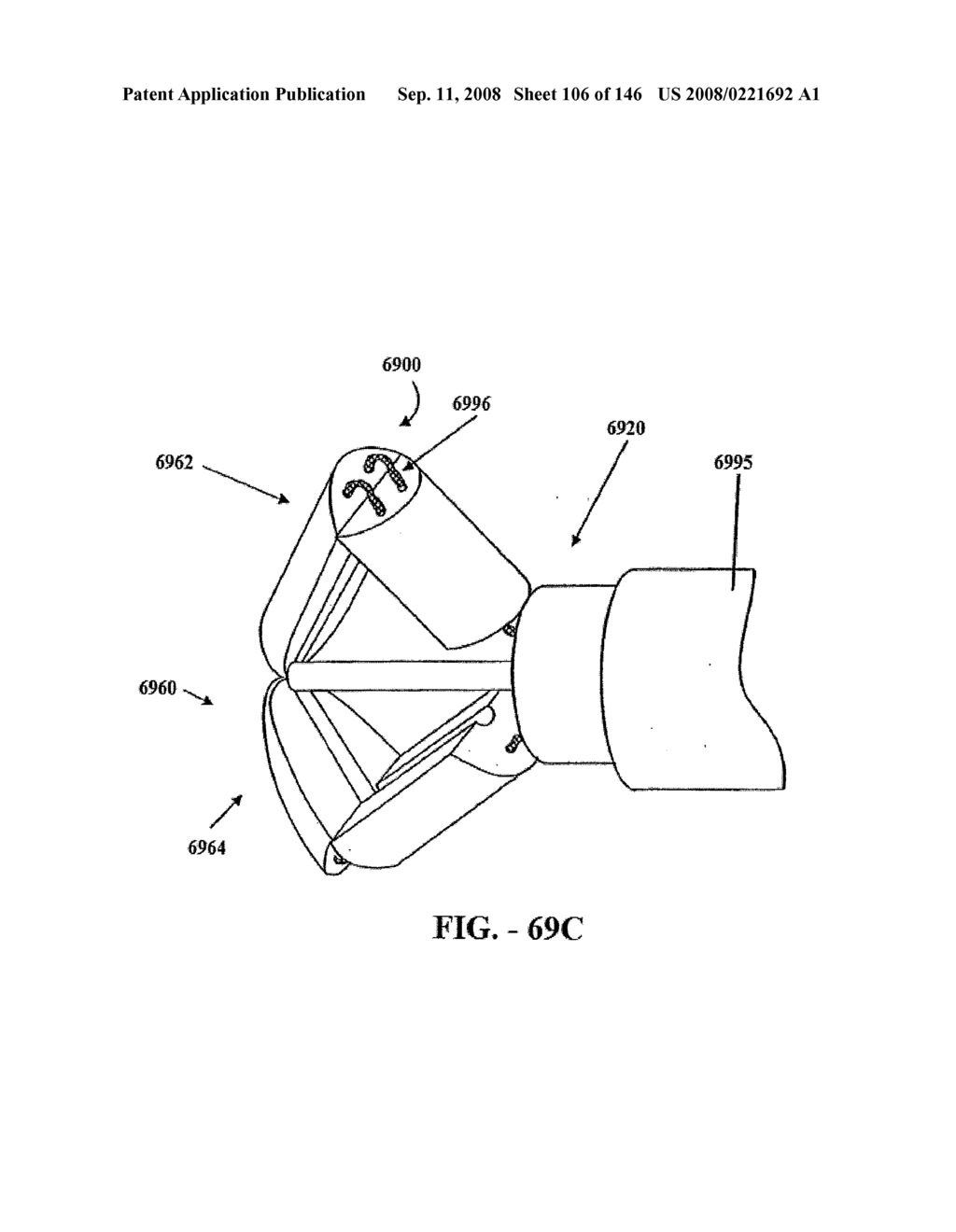 INTERSPINOUS PROCESS IMPLANTS AND METHODS OF USE - diagram, schematic, and image 108