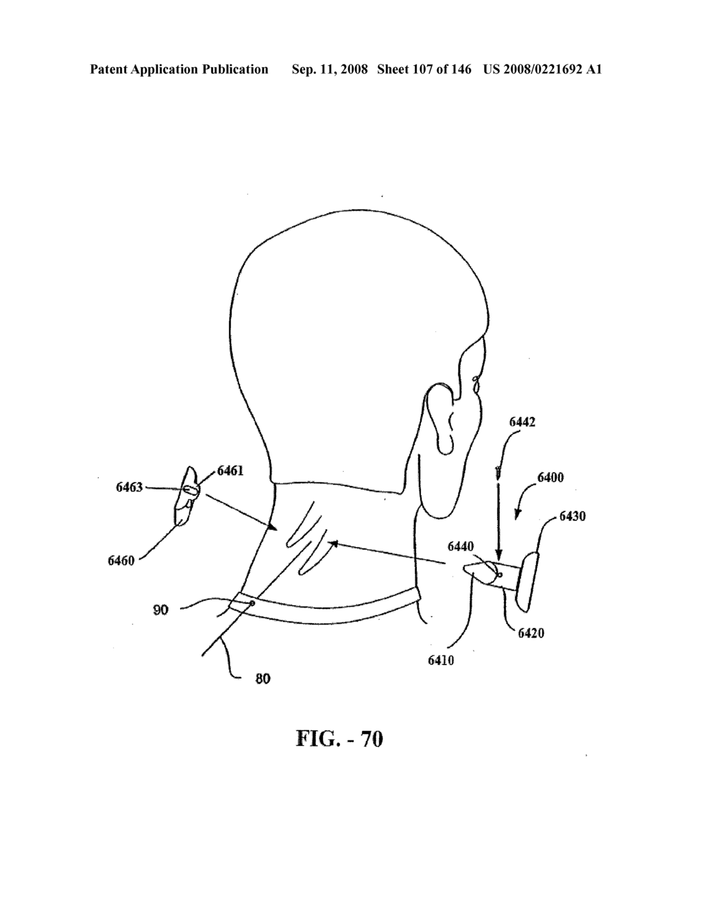 INTERSPINOUS PROCESS IMPLANTS AND METHODS OF USE - diagram, schematic, and image 109