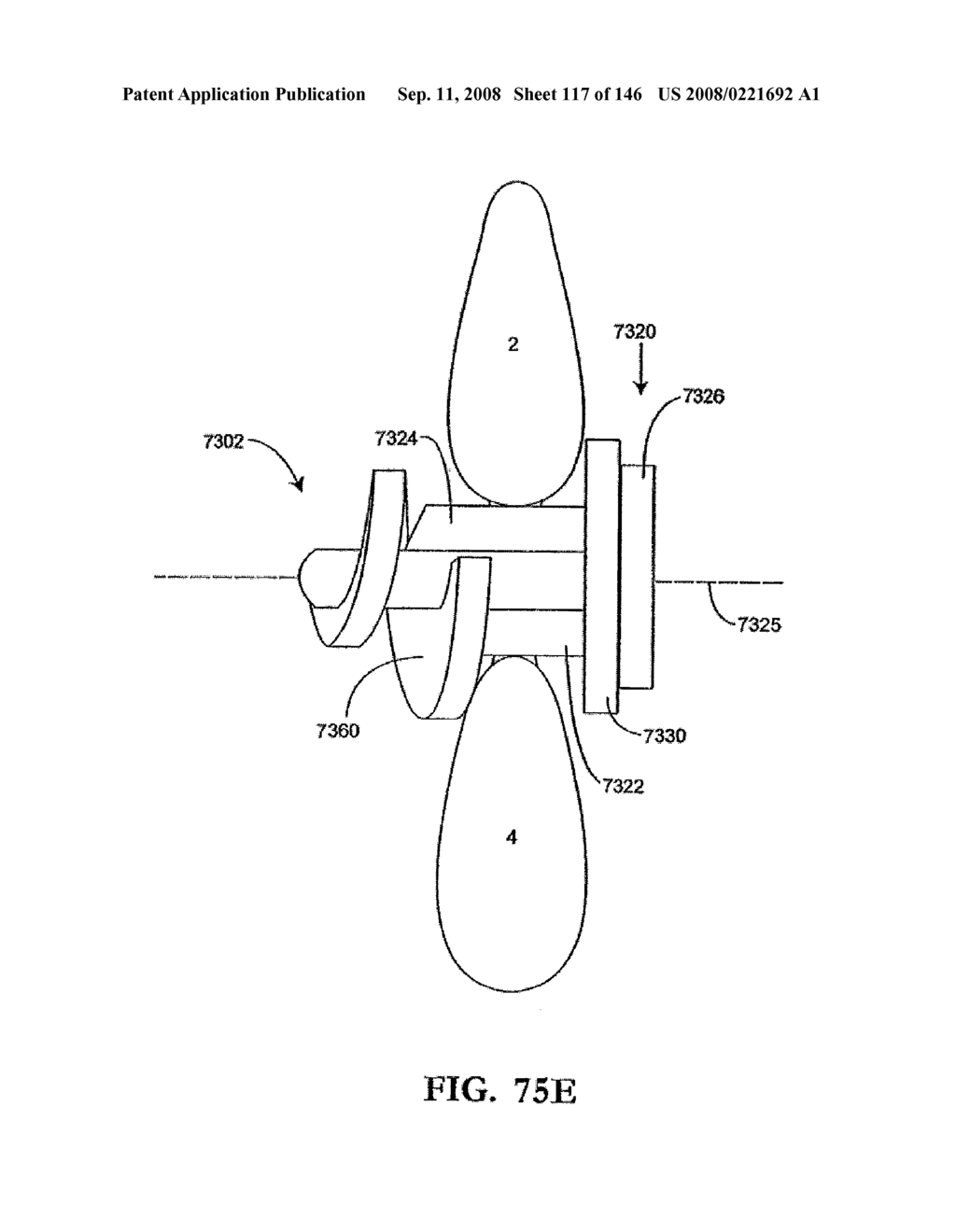 INTERSPINOUS PROCESS IMPLANTS AND METHODS OF USE - diagram, schematic, and image 119