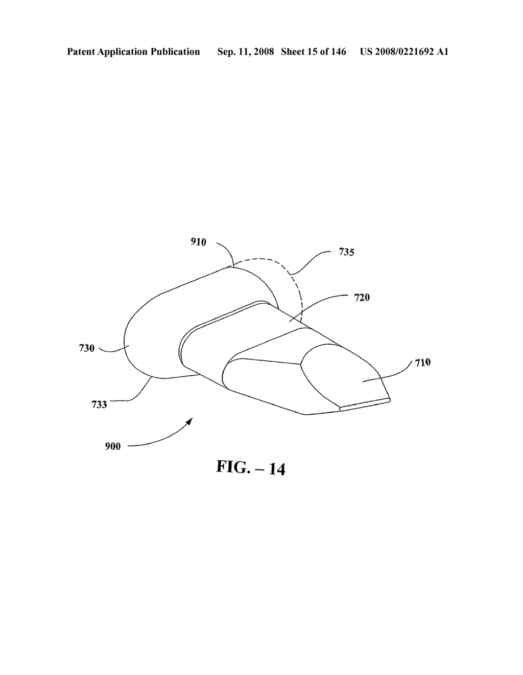 INTERSPINOUS PROCESS IMPLANTS AND METHODS OF USE - diagram, schematic, and image 17