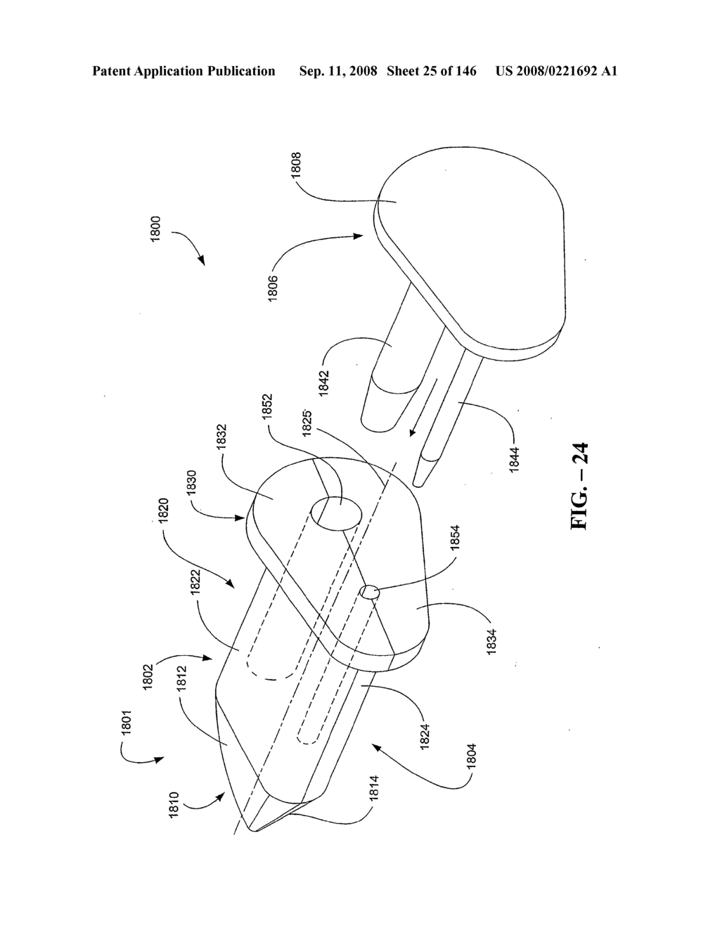 INTERSPINOUS PROCESS IMPLANTS AND METHODS OF USE - diagram, schematic, and image 27