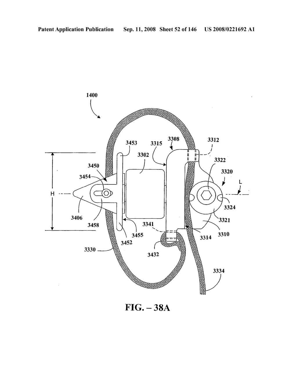 INTERSPINOUS PROCESS IMPLANTS AND METHODS OF USE - diagram, schematic, and image 54