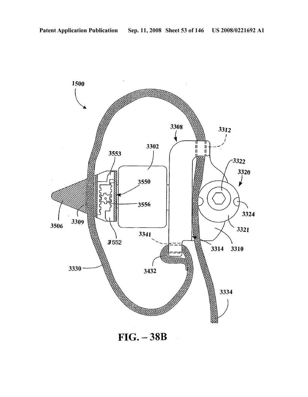 INTERSPINOUS PROCESS IMPLANTS AND METHODS OF USE - diagram, schematic, and image 55