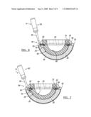 Method and apparatus for removing an acetabular bearing diagram and image