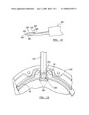 Method and apparatus for removing an acetabular bearing diagram and image