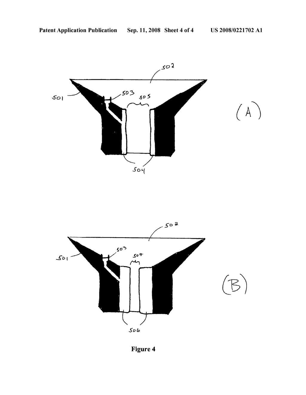 Methods and devices for intragastrointestinal prostheses - diagram, schematic, and image 05