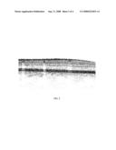 Method of motion correction in optical coherence tomography imaging diagram and image