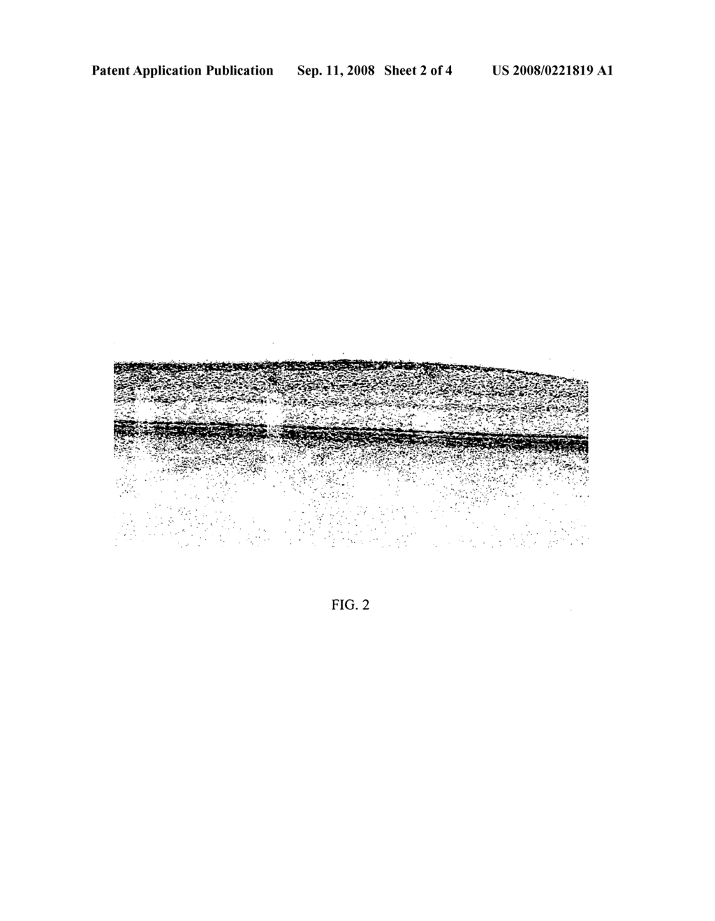 Method of motion correction in optical coherence tomography imaging - diagram, schematic, and image 03