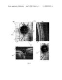 Method of motion correction in optical coherence tomography imaging diagram and image