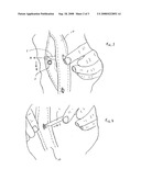 Button hook diagram and image