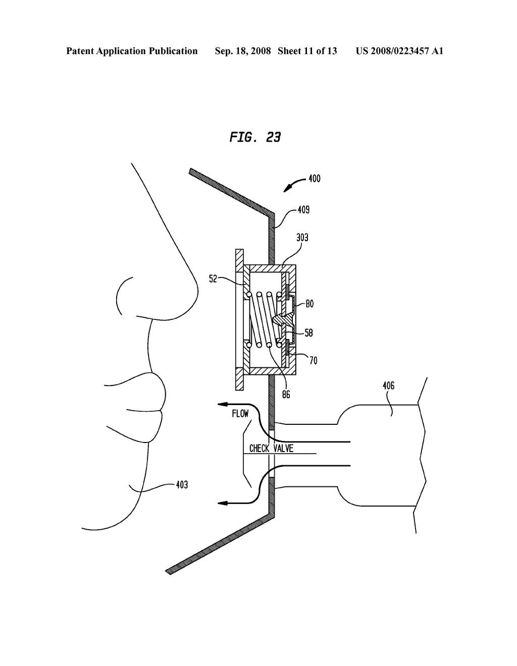 Bi-directional valve - diagram, schematic, and image 12