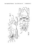 Snowmobile with externally mounted radiator diagram and image