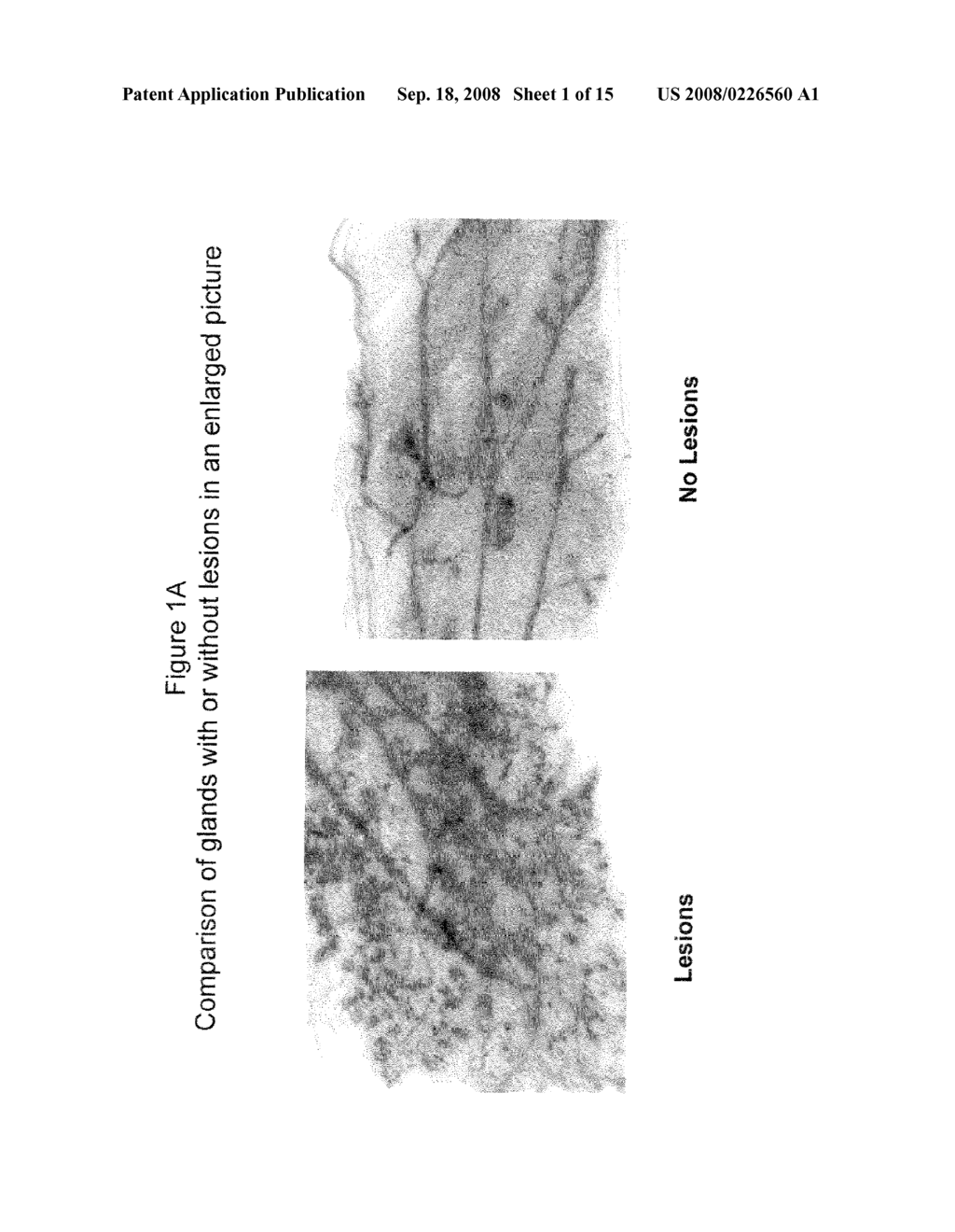 COMPOSITIONS AND METHODS TO PREVENT CANCER WITH CUPREDOXINS - diagram, schematic, and image 02