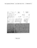 Vectors having both isoforms of beta-hexosaminidase and uses of the same diagram and image