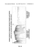 AMPHIREGULIN ANTIBODIES AND THEIR USE TO TREAT CANCER AND PSORIASIS diagram and image