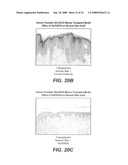 AMPHIREGULIN ANTIBODIES AND THEIR USE TO TREAT CANCER AND PSORIASIS diagram and image