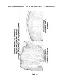 AMPHIREGULIN ANTIBODIES AND THEIR USE TO TREAT CANCER AND PSORIASIS diagram and image