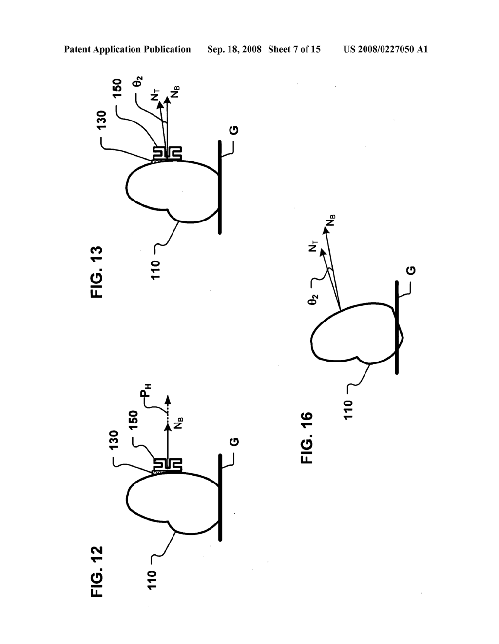 Bracket alignment devices and systems and methods of producing and utilizing the same - diagram, schematic, and image 08