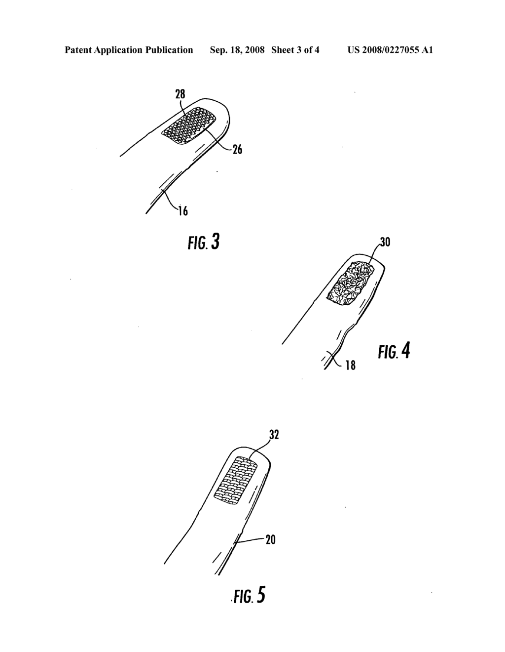 Dental hygiene device applicable for a variety of gum conditions - diagram, schematic, and image 04