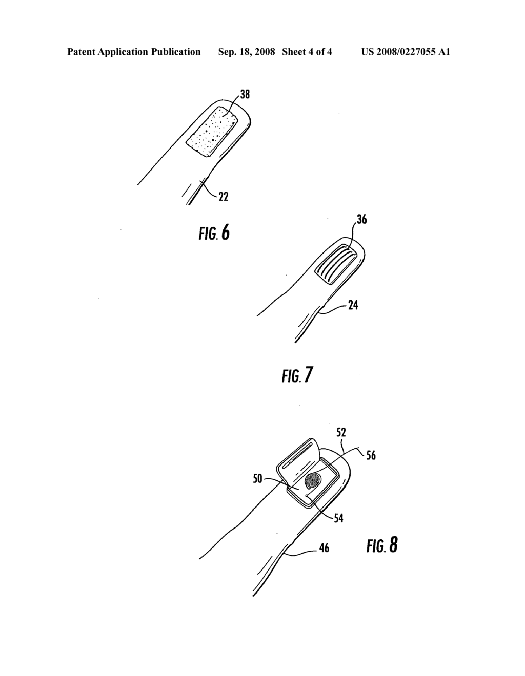 Dental hygiene device applicable for a variety of gum conditions - diagram, schematic, and image 05