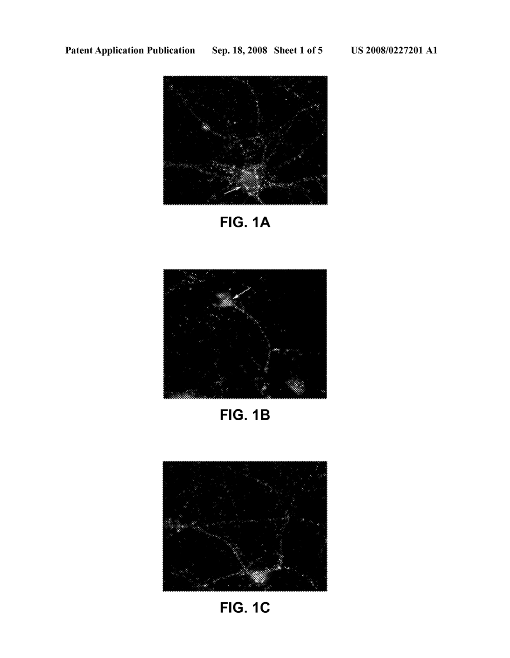 In vitro model for neuronal death - diagram, schematic, and image 02