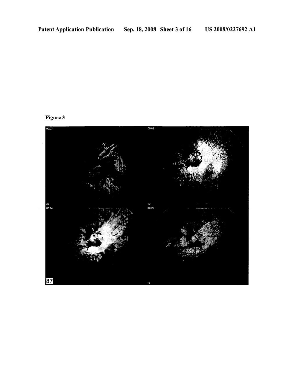 Compositions and methods for treating ophthalmic disorders - diagram, schematic, and image 04