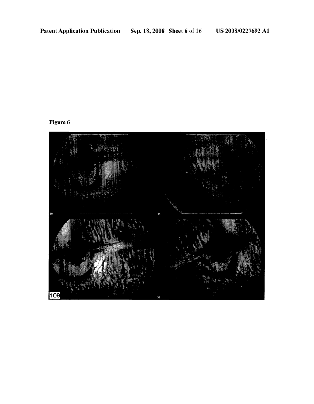 Compositions and methods for treating ophthalmic disorders - diagram, schematic, and image 07