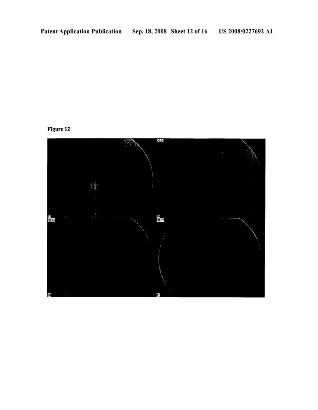 Compositions and methods for treating ophthalmic disorders - diagram, schematic, and image 13