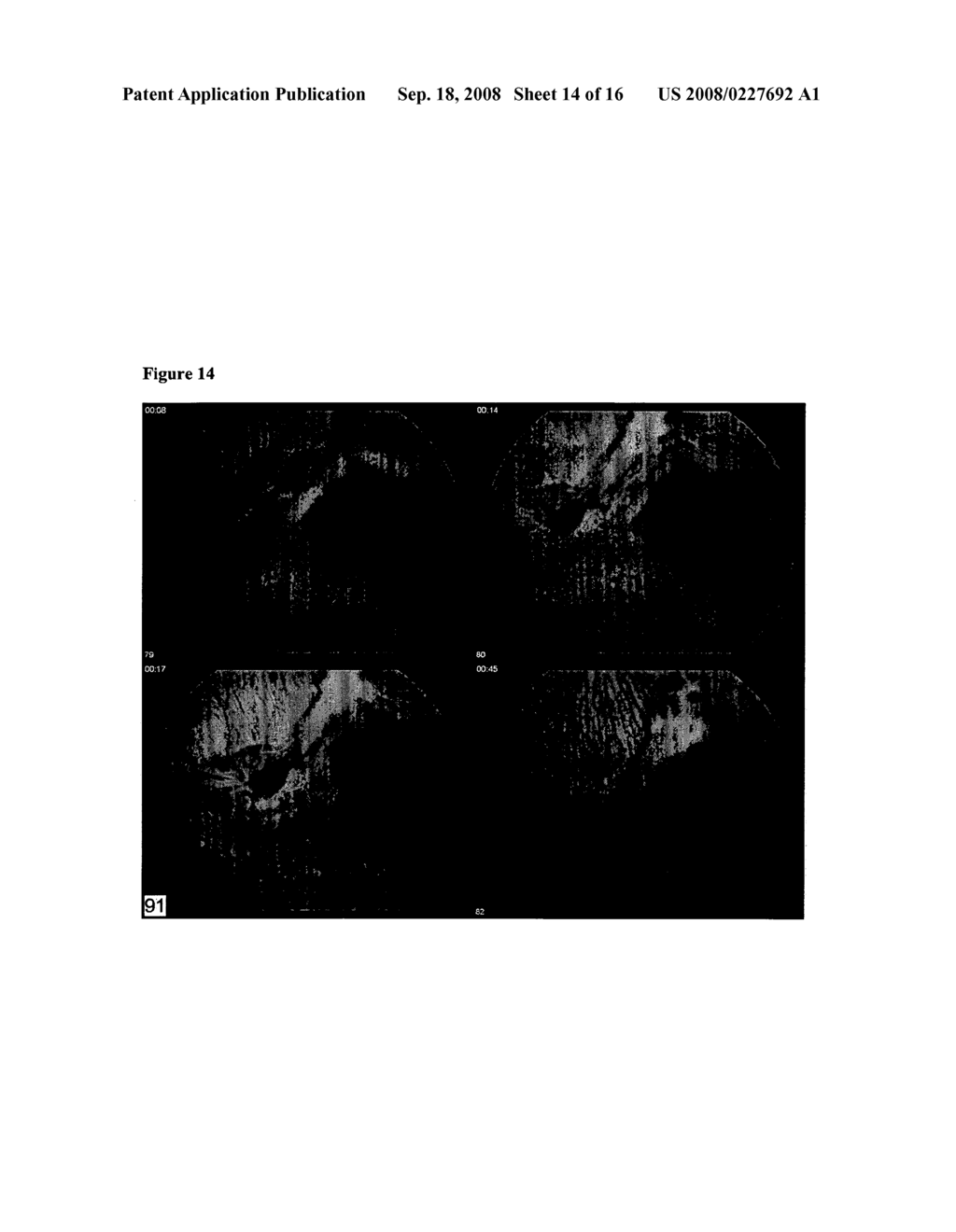 Compositions and methods for treating ophthalmic disorders - diagram, schematic, and image 15