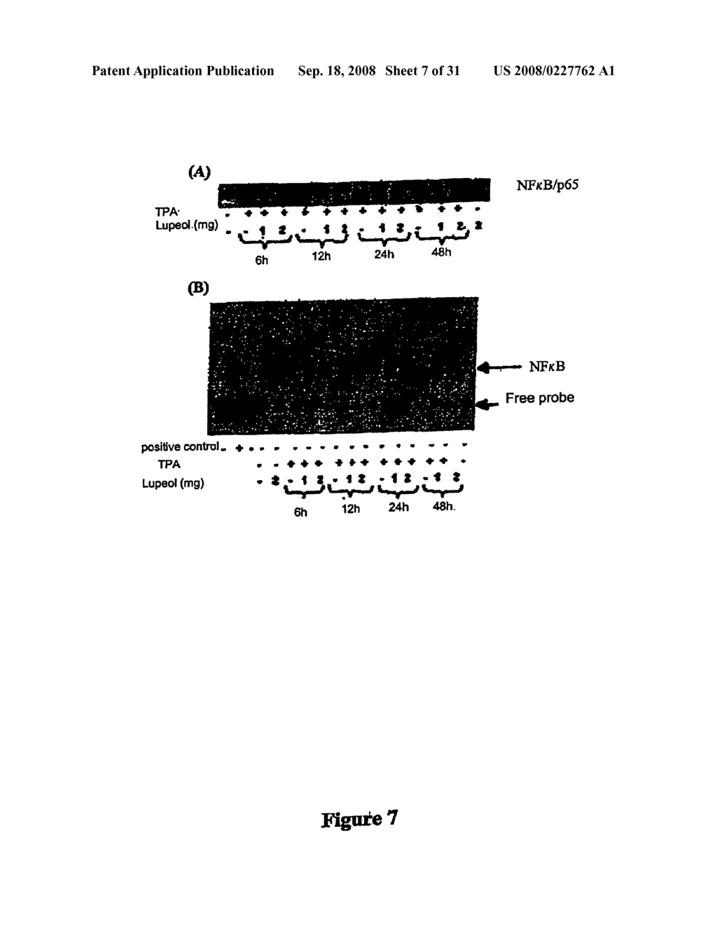 LUPEOL ANTI-TUMOR AGENT AND USES THEREOF - diagram, schematic, and image 08