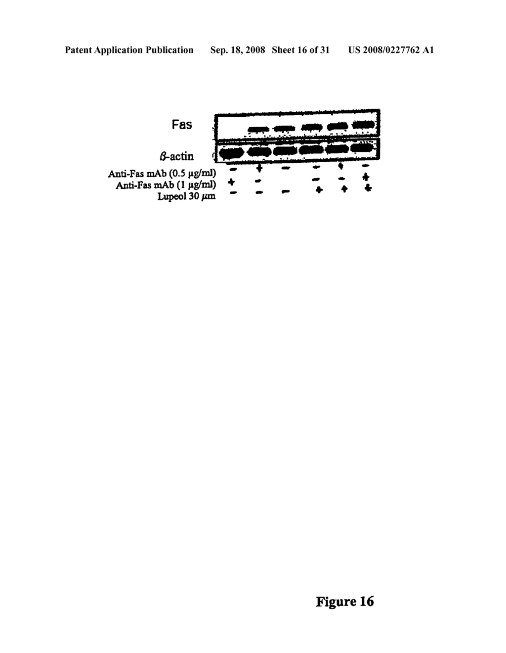 LUPEOL ANTI-TUMOR AGENT AND USES THEREOF - diagram, schematic, and image 17