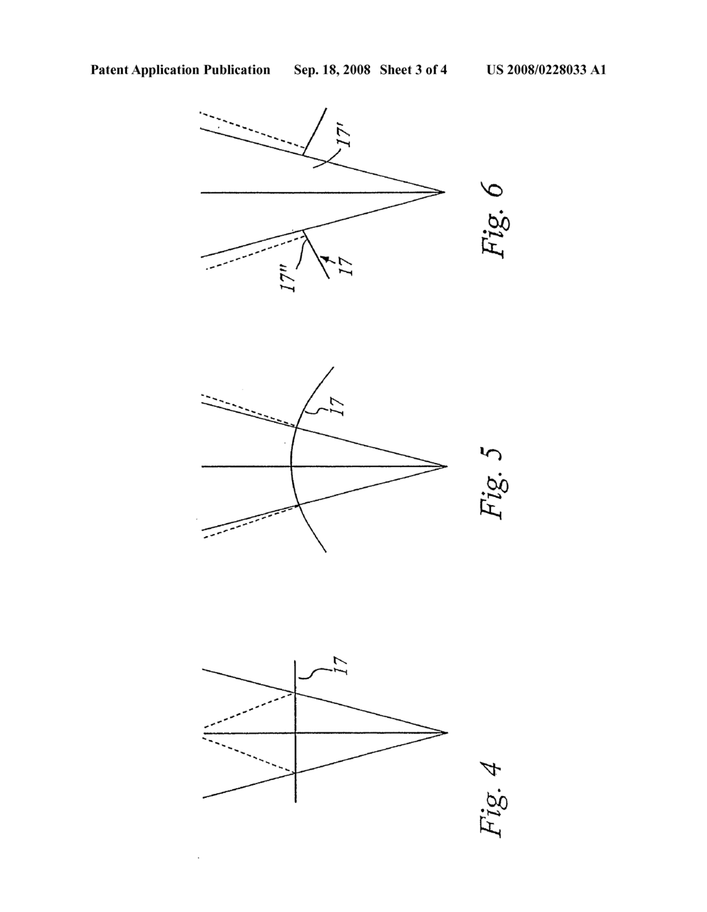 Optical Coherence Tomography Probe Device - diagram, schematic, and image 04