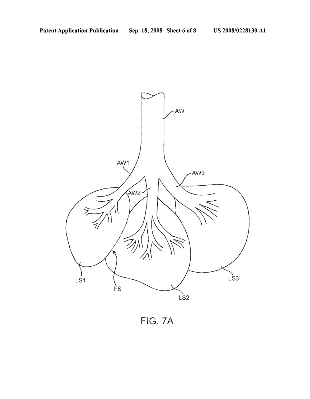 METHODS AND SYSTEMS FOR OCCLUDING COLLATERAL FLOW CHANNELS IN THE LUNG - diagram, schematic, and image 07