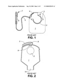 Colostomy bag diagram and image