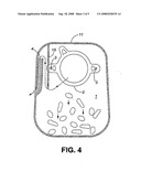 Colostomy bag diagram and image