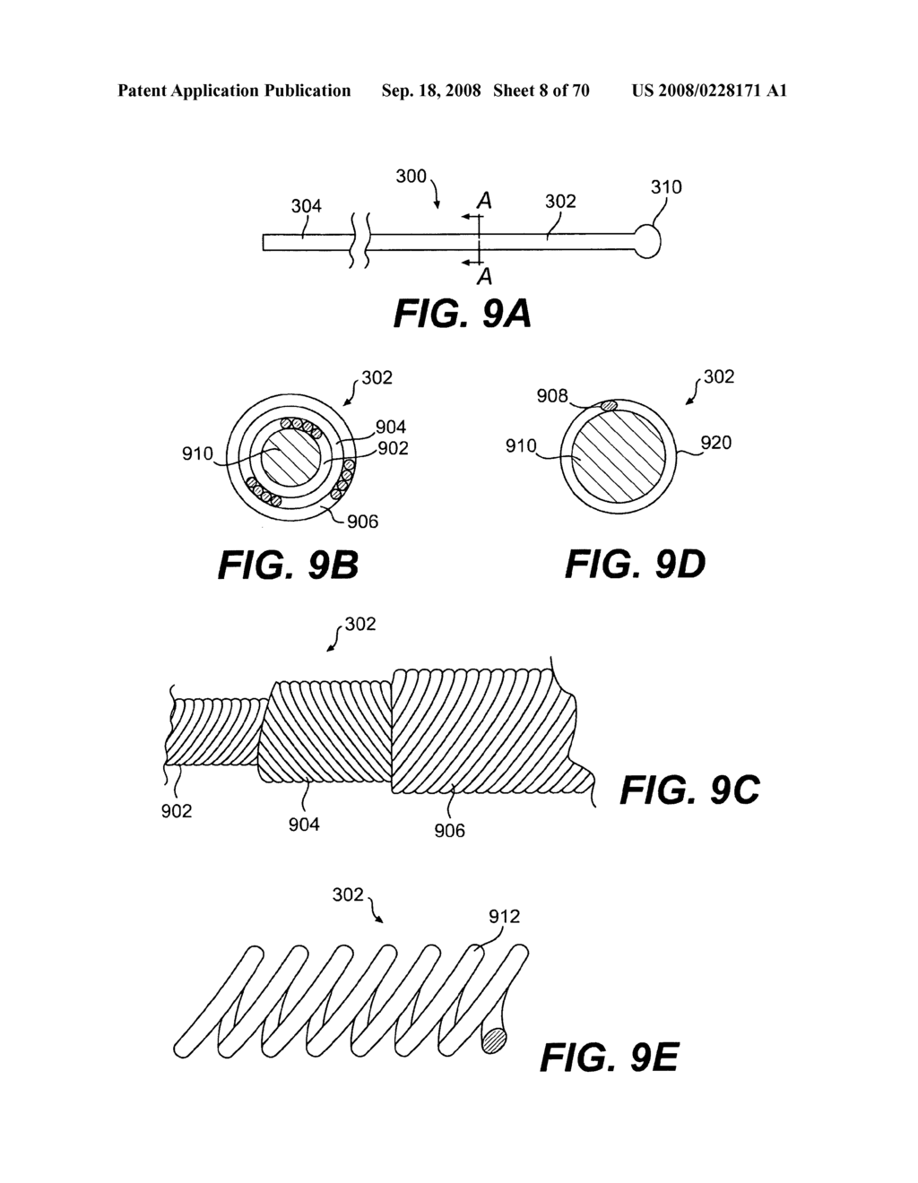 Endovascular devices and methods for exploiting intramural space - diagram, schematic, and image 09