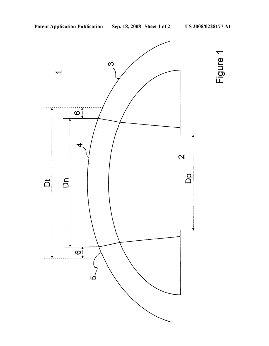 System and Method for Correction of Ophthalmic Refractive Errors - diagram, schematic, and image 02