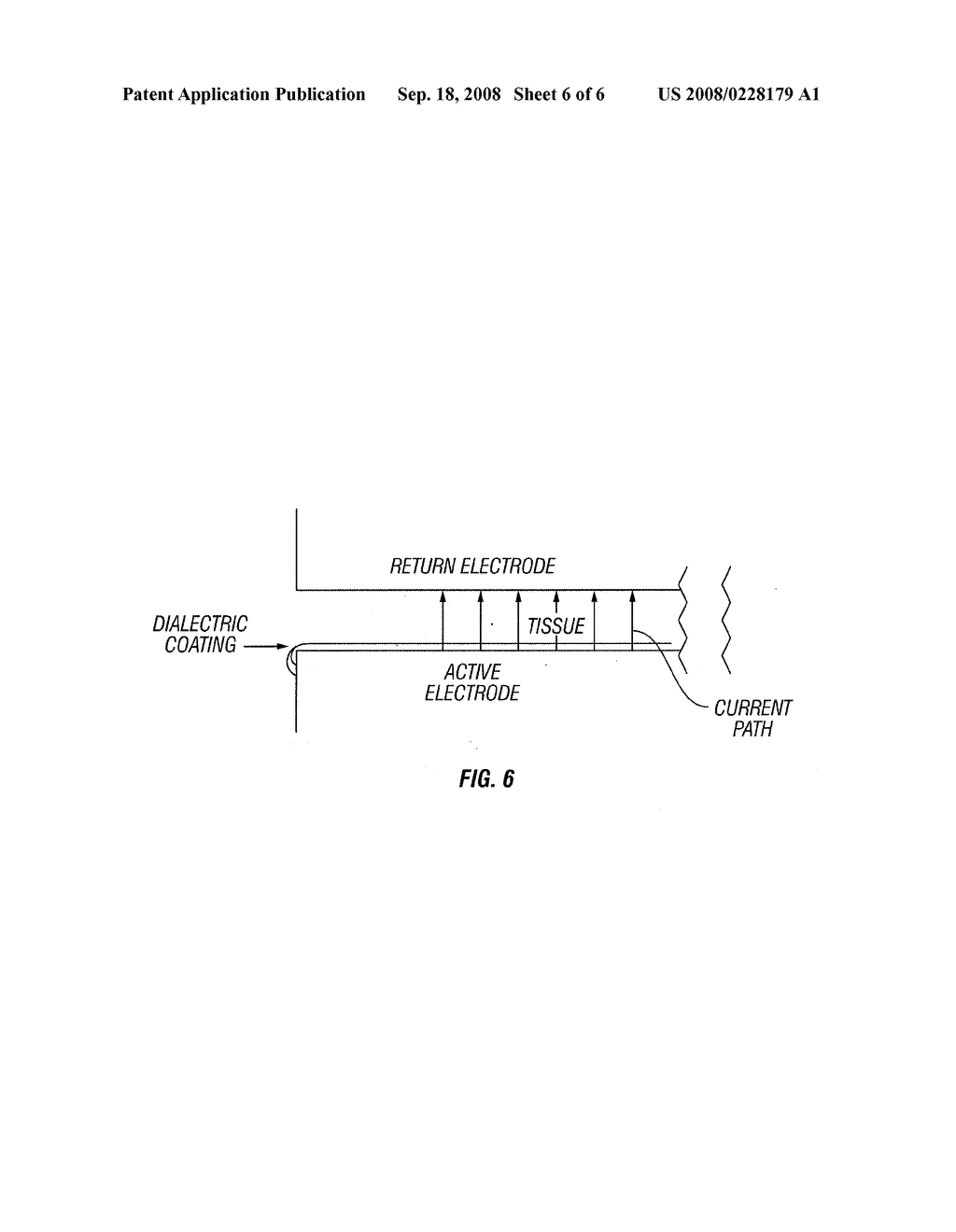 ELECTROCAUTERY METHOD AND APPARATUS - diagram, schematic, and image 07