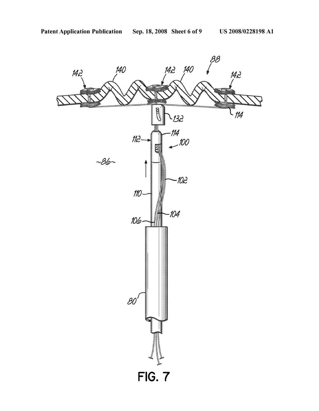 SUTURE CUTTER AND METHOD OF CUTTING SUTURE - diagram, schematic, and image 07